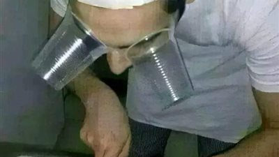 العبد المعيوب